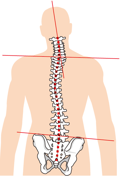 首や背中や腰の位置など背骨が歪んでいる