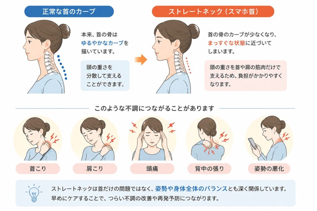 ストレートネック(スマホ首)の状態と首のカーブの違いを説明するイラスト