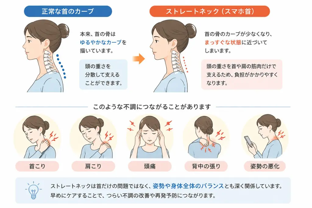 ストレートネック（スマホ首）｜大阪市鶴見区・今福鶴見の整体【快生